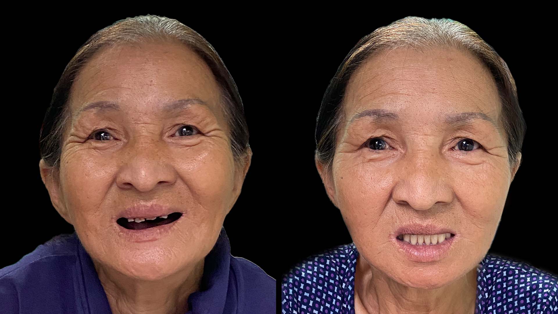 Nụ Cười Việt - NƠI TRÁI TIM NỞ NỤ CƯỜI I CÂU CHUYỆN SỐ 15: ĐỜI THÊM TIẾNG CƯỜI, NHÀ THÊM HẠNH PHÚC