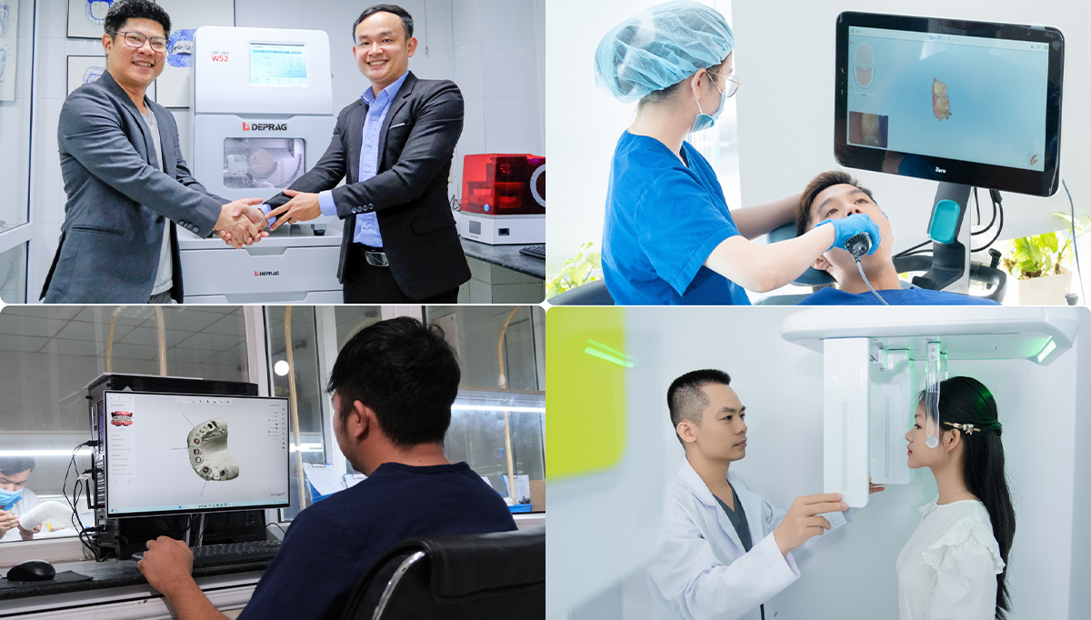nụ cười việt áp dụng máng hướng dẫn phẩu thuật implant vào điều trị