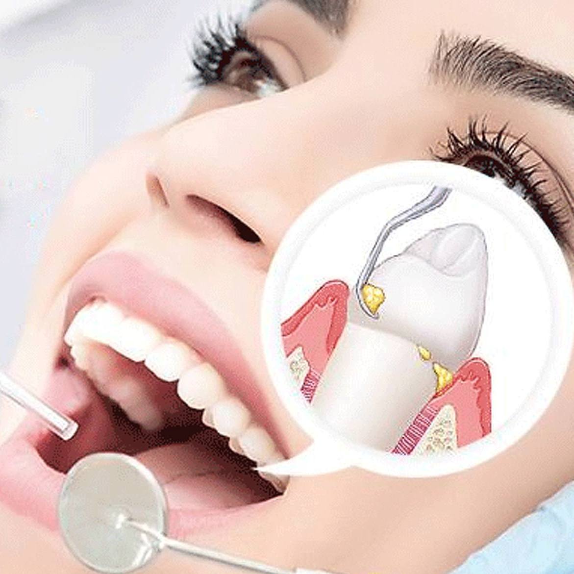 Nụ Cười Việt - Nha chu