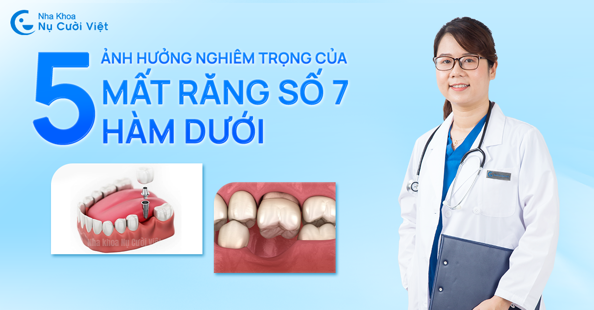 hậu quả của mất răng số 7