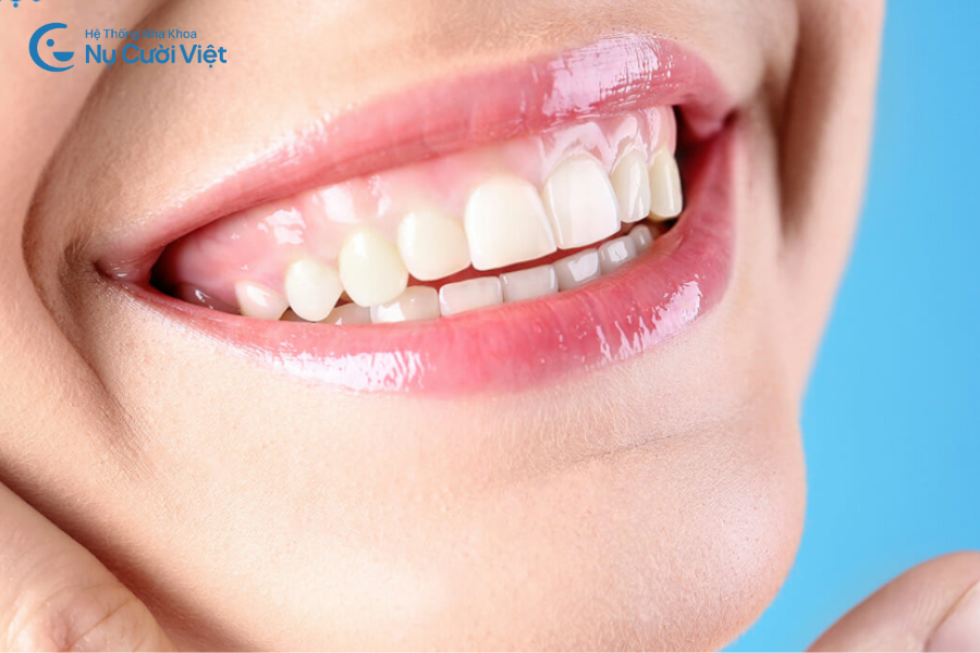 Nụ Cười Việt - Cắt lợi có đau không? Bao lâu thì lành và cần lưu ý gì?