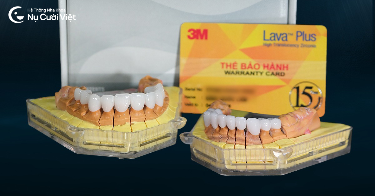 cách để răng sứ không bị xuống màu