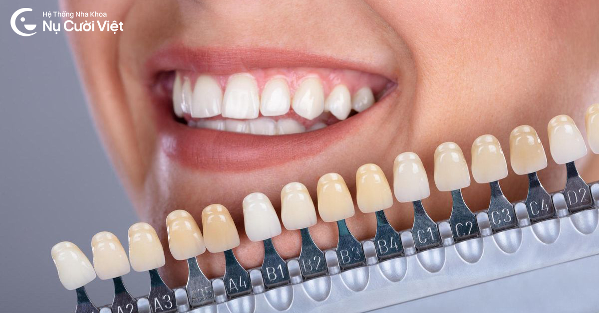 răng sứ có bị xuống màu không